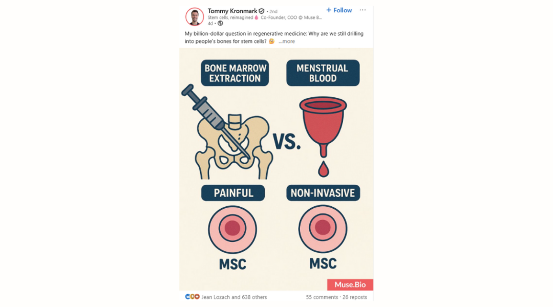 Medical illustration comparing bone marrow extraction with menstrual blood collection for mesenchymal stem cells, labeled as painful vs. non-invasive.